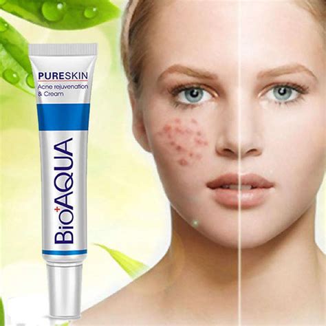 1xbioaqua Pure Skin Face Care Cream Acne Health Treatment Scar Removal