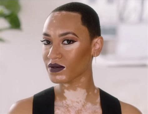 Check spelling or type a new query. CoverGirl Features Their First Black Model with Vitiligo in New Campaign | Houston Style ...