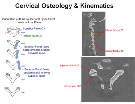 Cervical Spine Anatomy Spine Orthobullets