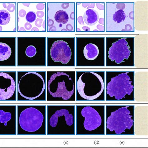 Five Types Of Wbc Cell Neutrophil Lymphocyte Eosinophil Monocyte