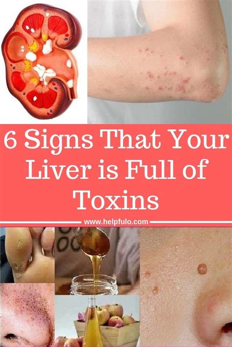 Detox Liver And Kidneys Liverdetox Healthy Drinks Detox Liver Detox