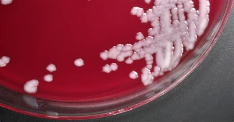 Cdc Moves To Contain Anthrax Exposure