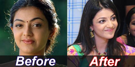 South Indian Actress Images Who Undergone Plastic Surgery