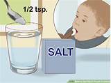 Thrush Medication For Infants