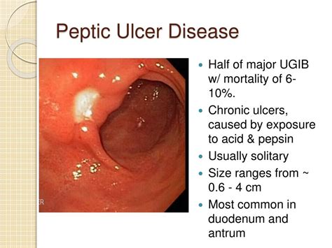 Ppt Gastrointestinal Bleeding Powerpoint Presentation Id547157