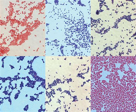 Gram Positive Bacterial Infections Bacterial Infections Gram Positive