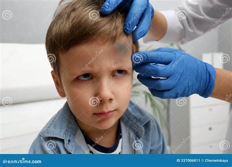 Doctor Checking Boy`s Forehead With Bruise At Hospital Closeup Stock