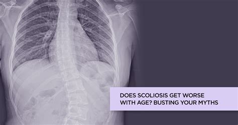 Scoliosis Treatment Types Of Scoliosis Scoliosis Causes