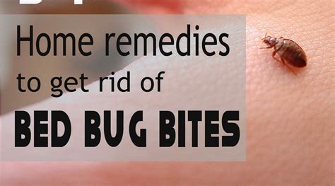 Home Remedies To Treat Bed Bug Bites Bed Bugs Bed Bug Bites Bed
