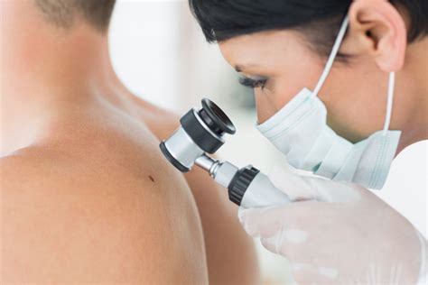 Annual Skin Cancer Exam The Dermatology Specialists