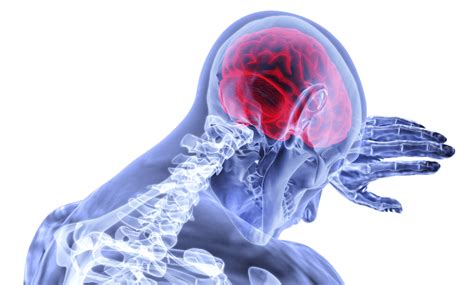 Brain Tumor 10 Warning Signs And Symptoms Types Extrachai