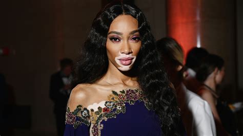 Winnie Harlow Makes History As Sports Illustrateds First Swimsuit