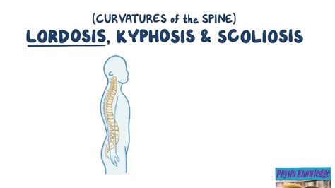 Curvatures Of The Spine Lordosis Kyphosis And Scoliosis Youtube
