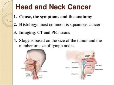 End Stage Head And Neck Cancer Maple Suyrup Diet