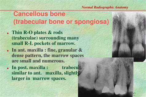 Ppt Normal Radiographic Anatomy Based On Intraoral Films Powerpoint