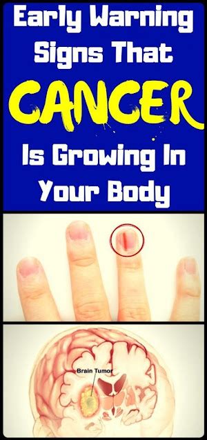 Early Warning Signs That Cancer Is Growing In Your Body Wellness Magazine