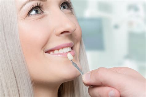 Minimal And No Prep Dental Veneers What They Are And How Much They Cost