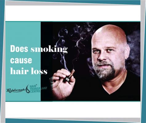 Would you have hair loss when taking remicade? Does Smoking Cause Hair Loss? - Hair Transplant Centre