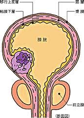 人或高等动物体内储存尿的器官，囊状，位于盆腔内。 是由平滑肌肉构成的，有很大的伸缩性。 尿由肾脏顺着输尿管进入膀胱。 有的地区叫尿脬（suīpāo）。 人类的膀胱位于盆腔内、 直肠的前面, 收集来自输尿管的尿液, 并通过由括约肌开闭的口间歇性地将尿液排出体外. 膀胱がん治療で30年ぶりのブレイクスルー! - メディカル・イン ...
