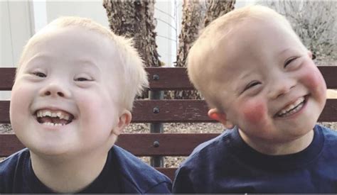Jess Graham On Twitter 3 Year Old Down Syndrome Twins Socialmedia Inspiration T