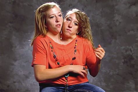 Abby And Brittany Hensel Their Unexpected Future Travelfuntu Twins Conjoined Twins Two Girls