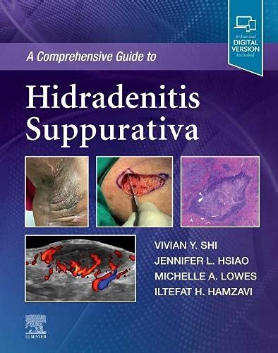 A Comprehensive Guide To Hidradenitis Suppurativa Wantitall