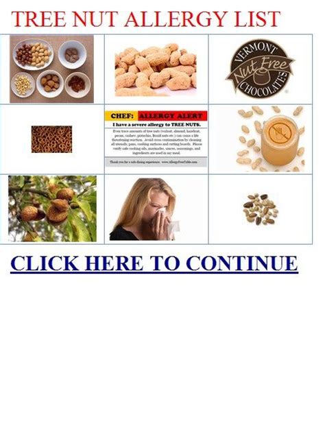 What Are Tree Nuts List Pleasure Binnacle Fonction