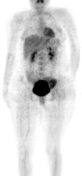 Musculoskeletal Tumors Radiology Key