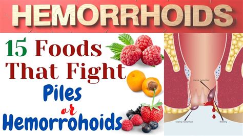 15 Helpful Foods For Hemorrhoids Best Foods For Piles And Fistula