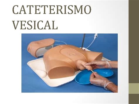 CATETERISMO VESICAL INTRODUCCIN El Cateterismo Vesical O Uretral