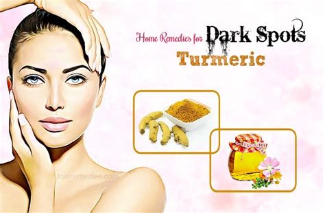 39 Amazing Home Remedies For Dark Spots On Face