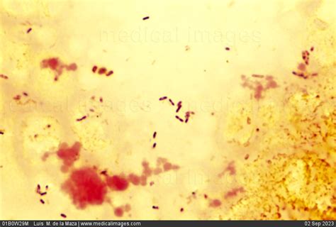 Listeria Monocytogenes Gram Stain Images Img Aaralyn