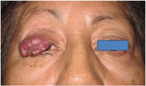 We encourage you to make connections; Cancers | Free Full-Text | Merkel Cell Carcinoma of the ...
