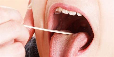 Quanto tempo dura Strep garganta Tratamento Home remédios para se livrar da Strep Throat