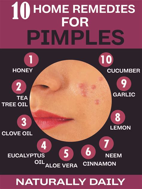 16 Natural Home Remedies For Pimples Evidence Based Pimples