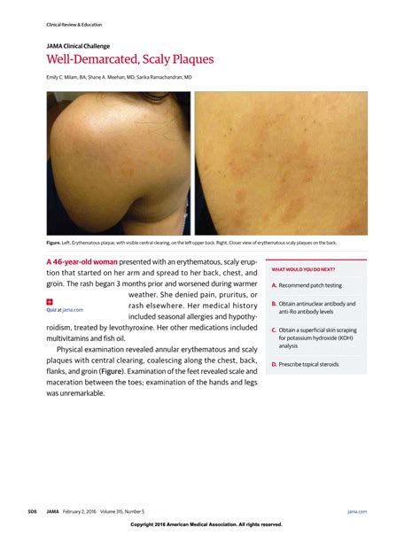 Well Demarcated Scaly Plaques Dermatology Jama Jama Network