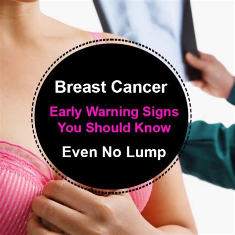 Breast Cancer Early Warning Signs You Should Know Health Nigeria
