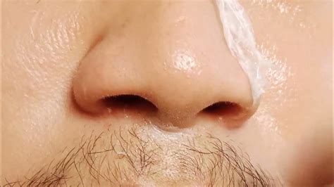 Peeling Nose Skin Youtube