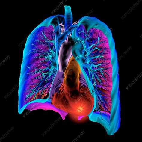 Heart And Lungs 3d Ct Scan Stock Image C0368944 Science Photo