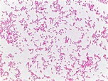 E. coli gram stain | Микробиология