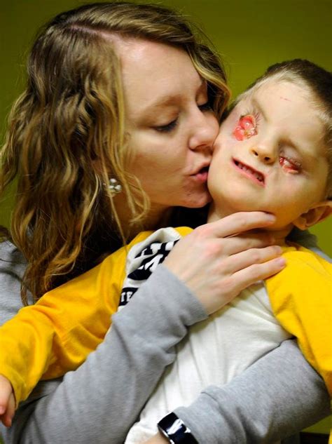 4 Year Olds Rare Birth Defect Inspires Blinding Love
