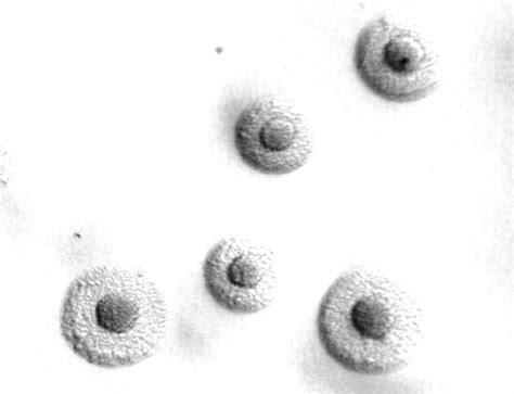 Mycoplasma Pneumoniae Colony Morphology
