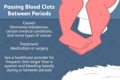 Passing Blood Clots When Not On Your Period