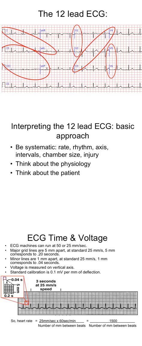 12 Lead Ecg Interpretation Ecg Interpretation 311