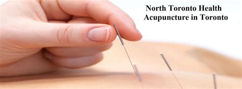 Traditional Chinese Medicine Acupuncture Services