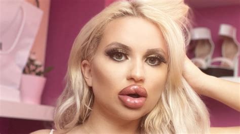 Woman Spends On Plastic Surgery To Look Like Barbie The Advertiser