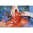 Hysterectomy For Uterine Fibroids Photograph By Cnri/science Photo Library