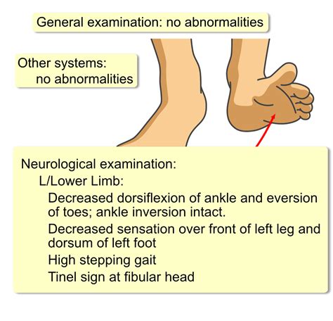 Common Peroneal Nerve Palsy Interactive Case Study Clinical Odyssey