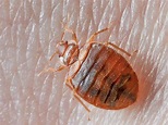 Bed Bugs - Bed Bug Bites - How to Get Rid of Bed Bugs