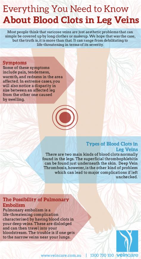 10 Signs Of Blood Clot